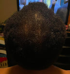 Nikki Smith Hair Growth Oil - Nikki Smith Collection