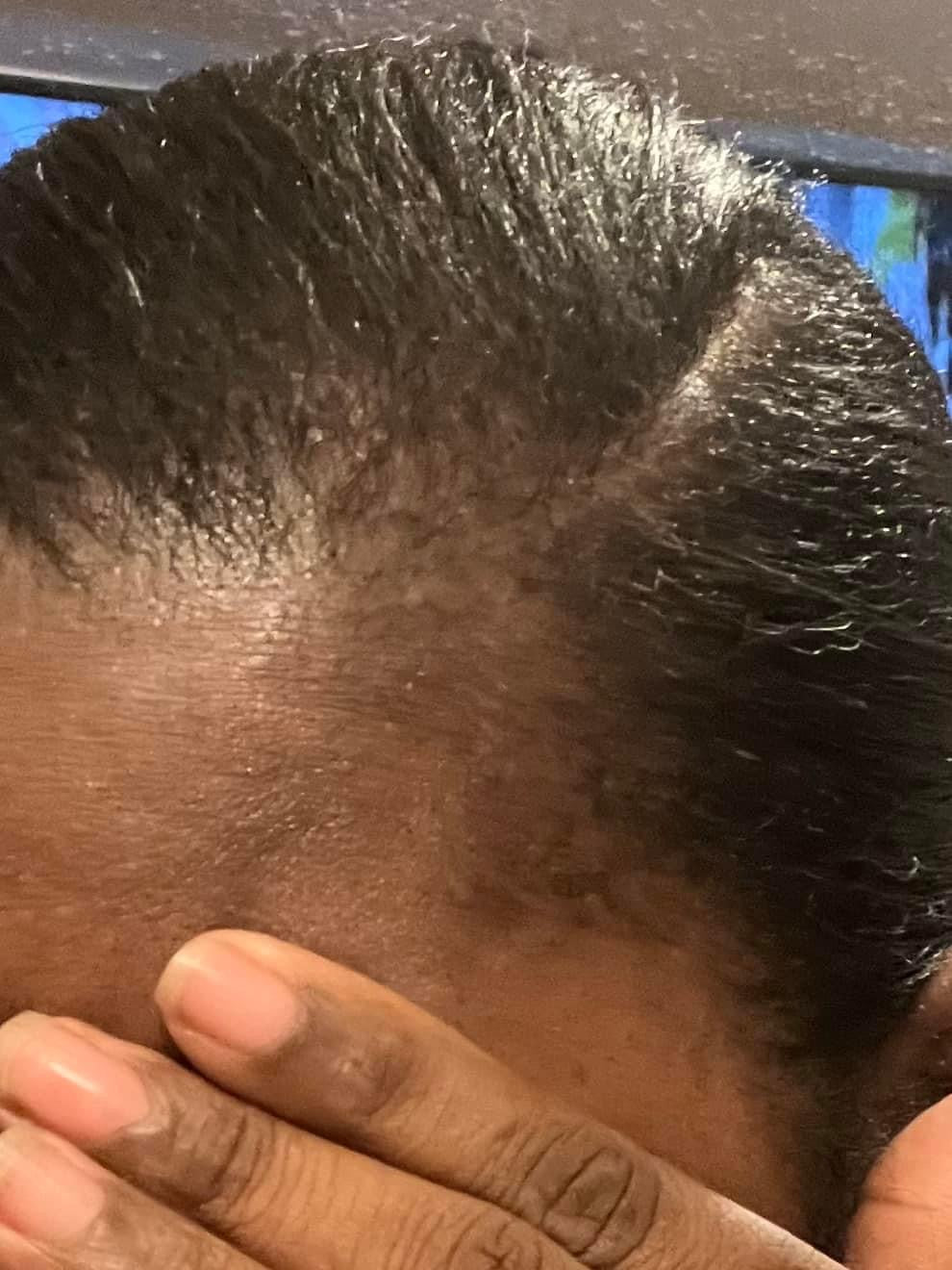 Nikki Smith Hair Growth Oil - Nikki Smith Collection